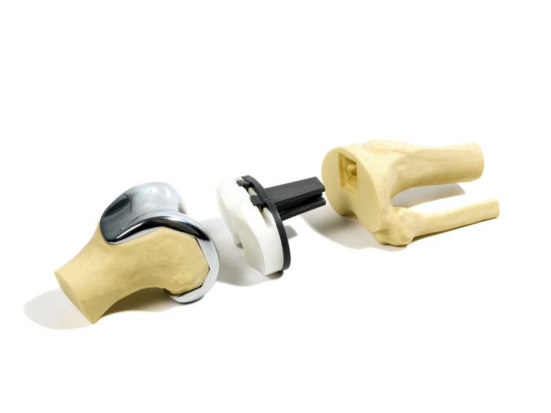 knee arthroplasty implant